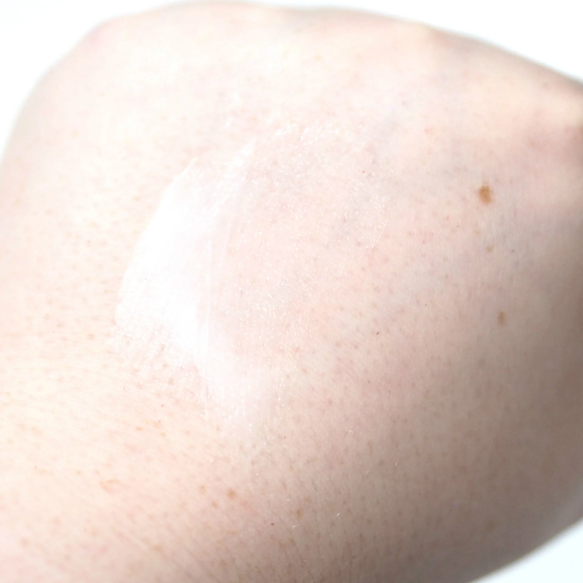 CeraVe SA Smoothing Cream Review Miracle Worker For Keratosis Pilaris