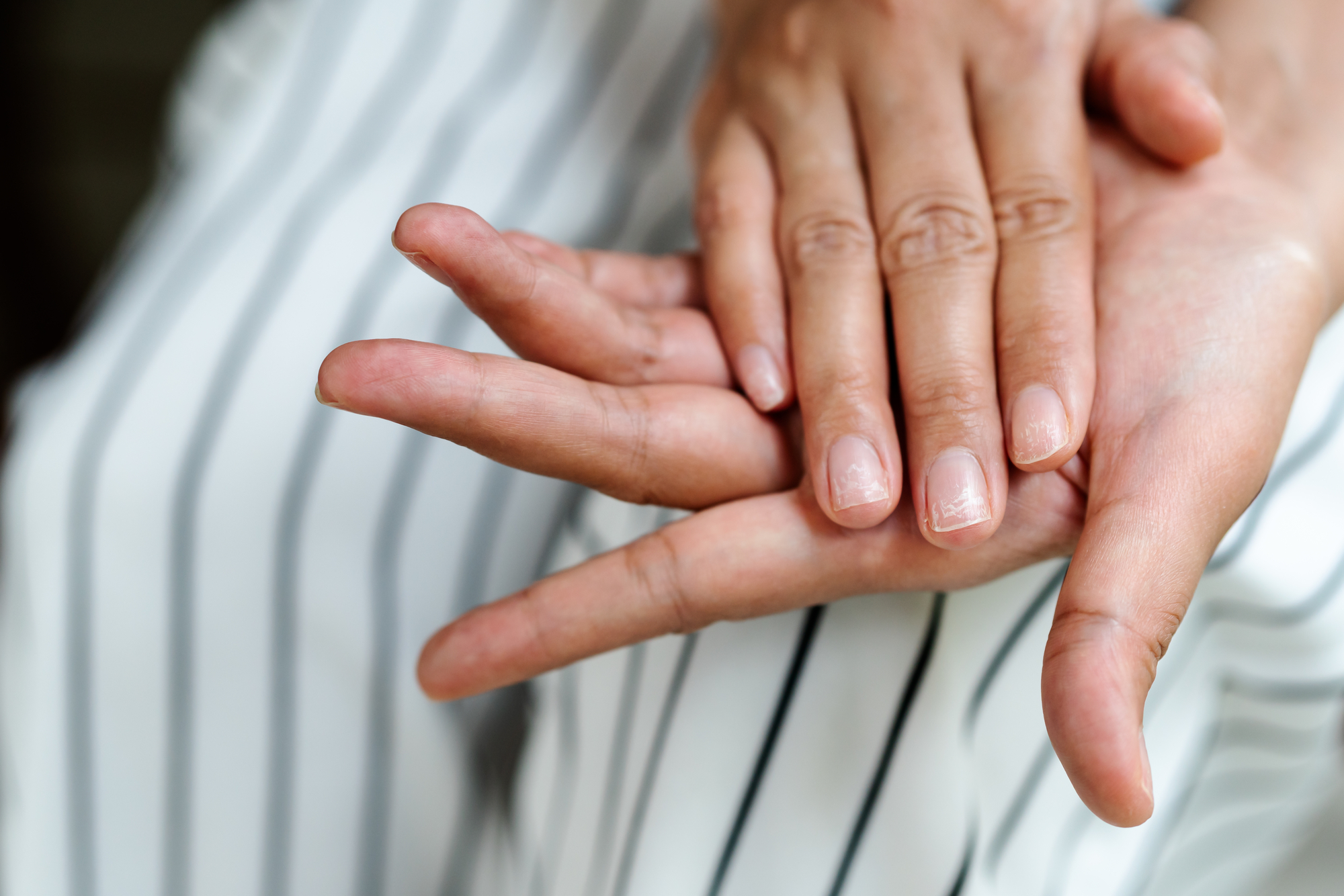 Woman wearing a striped jumpsuit looking at her damaged nails after having acrylic nails