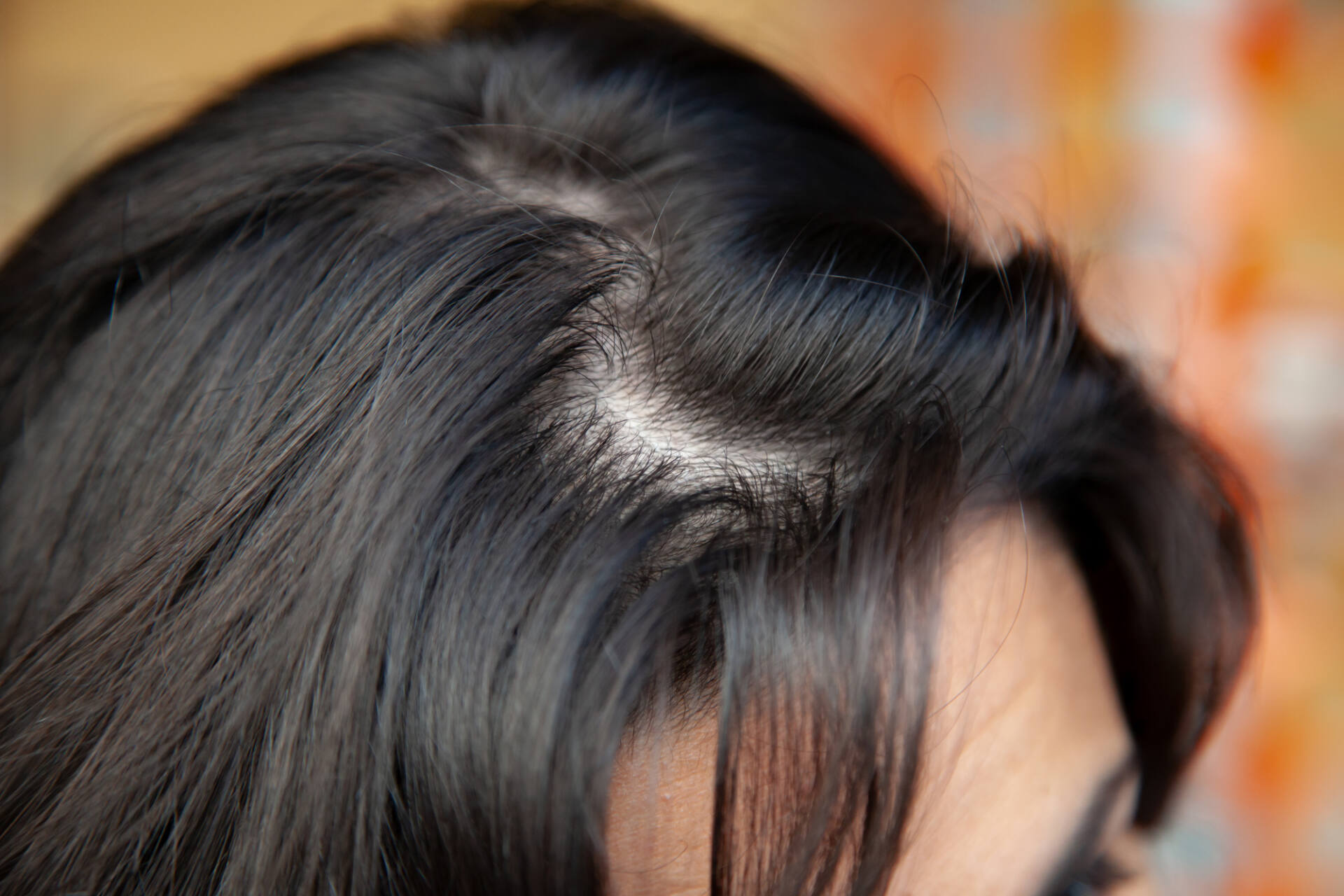 How To Tell If Your Hair Is Thinning  7 Things That Can Help