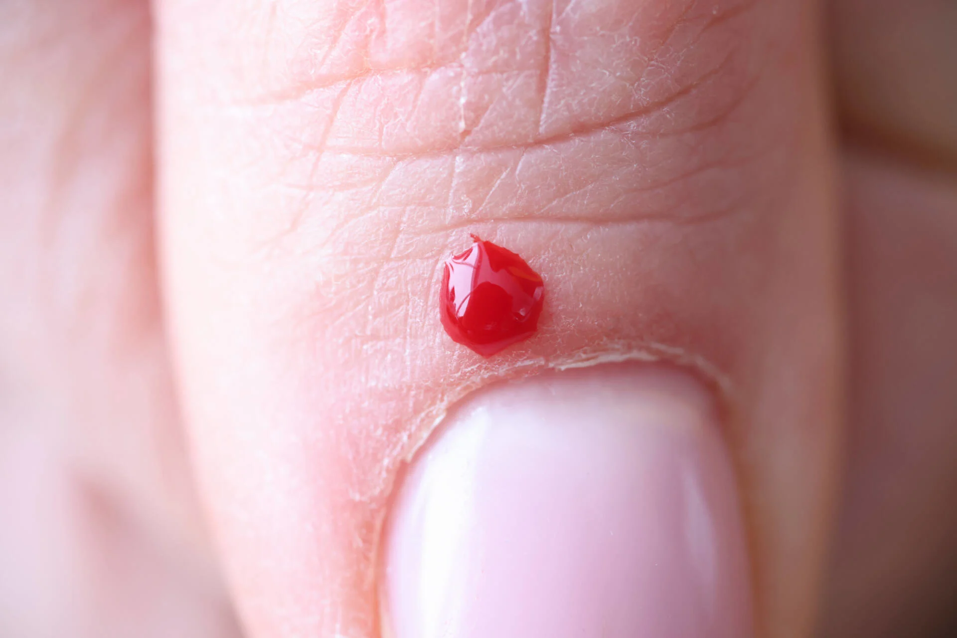 How To Get Splinter Out From Under Nail? [Quick & Easy]