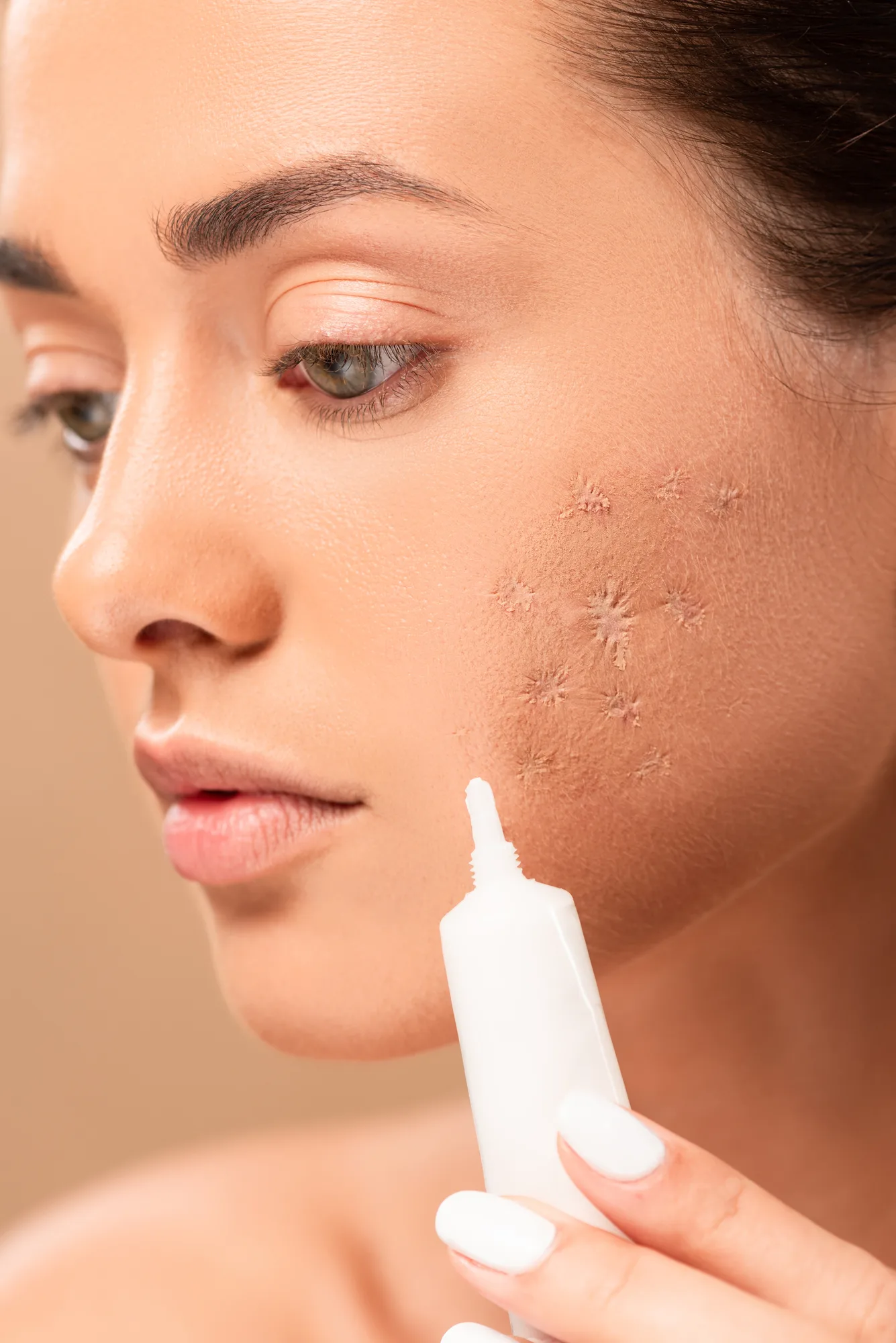 What Is The Best Primer For Acne Scars? [Ultimate Guide]