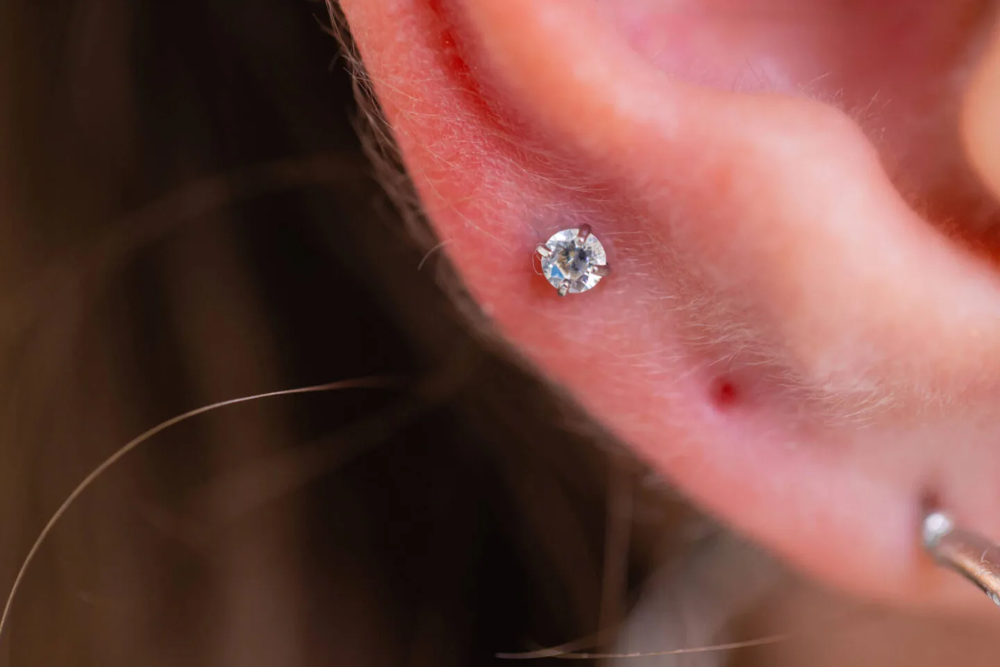 Benefits Of Using Apple Cider Vinegar On Piercing Bump