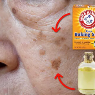 Castor Oil And Baking Soda For Age Spots