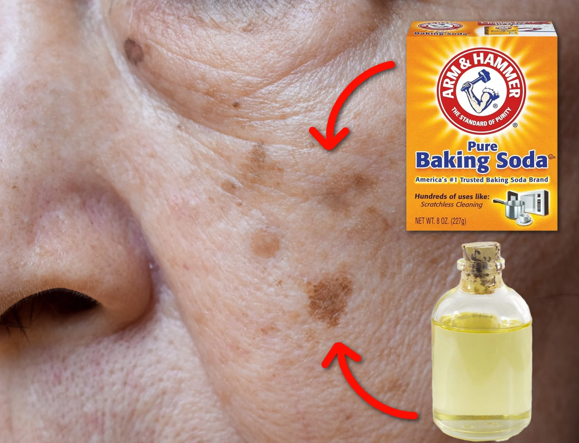 Castor Oil And Baking Soda For Age Spots