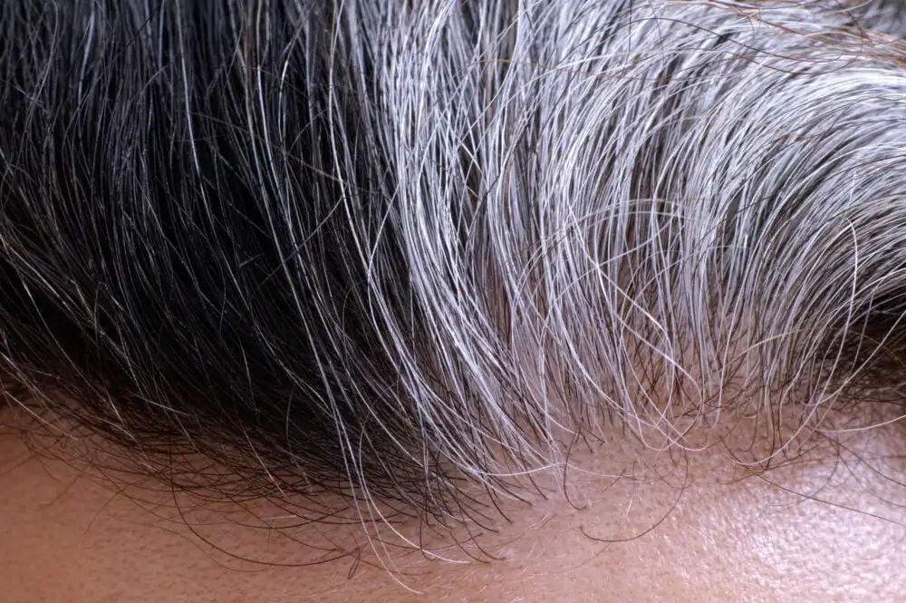 When Do People Start Getting Gray Hair?