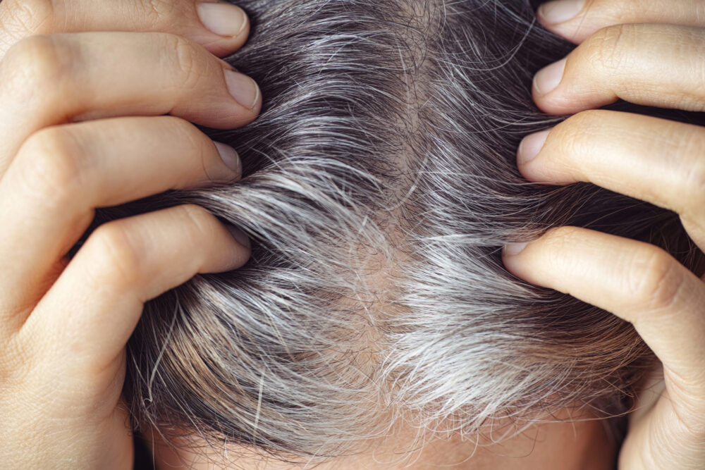 When Do People Start Getting Gray Hair?