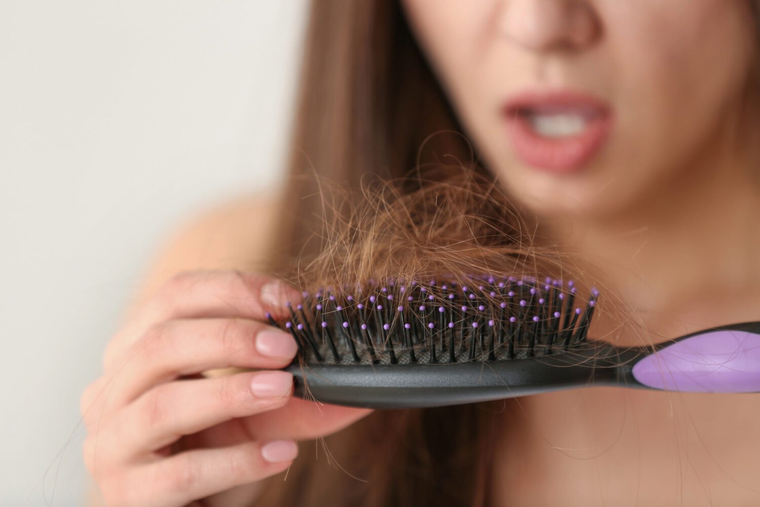 5 Most Common Causes Of Hair Loss In Women