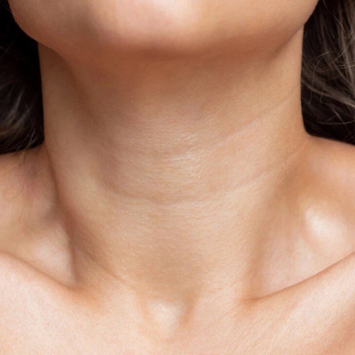 Why Do Neck Lines and Wrinkles Form?