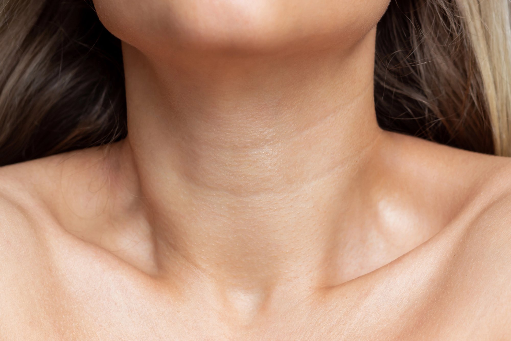 Why Do Neck Lines and Wrinkles Form?