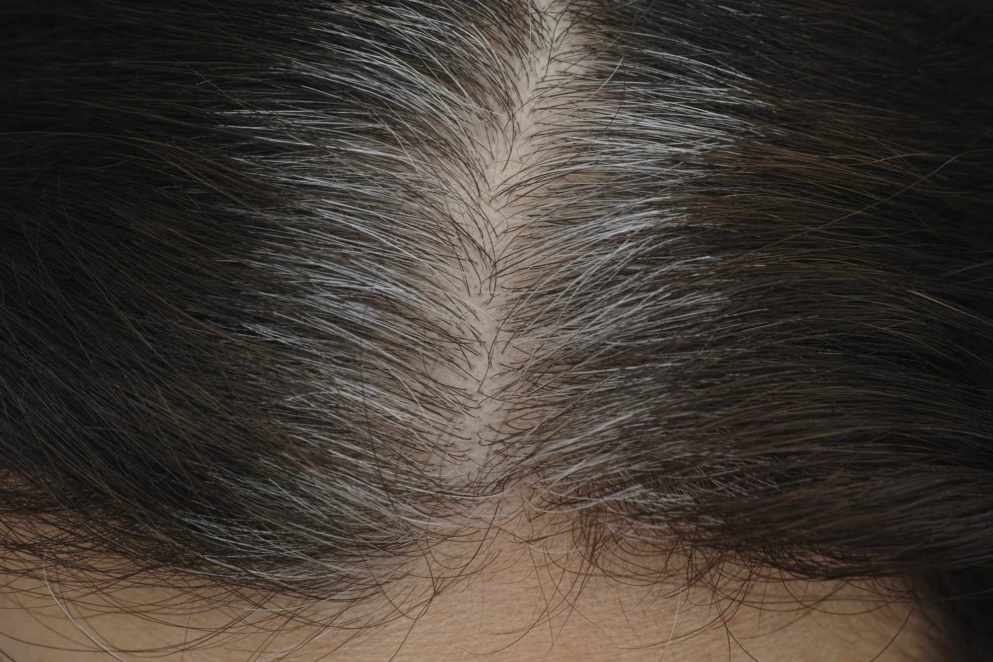 Why Are Grey Hairs Thicker Than Normal Hairs?